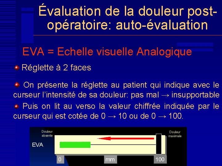 Évaluation de la douleur postopératoire: auto-évaluation EVA = Echelle visuelle Analogique Réglette à 2