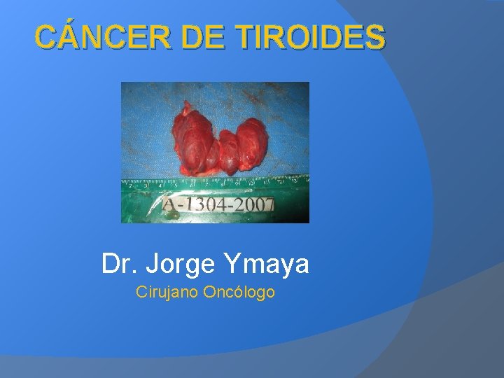 CÁNCER DE TIROIDES Dr. Jorge Ymaya Cirujano Oncólogo 