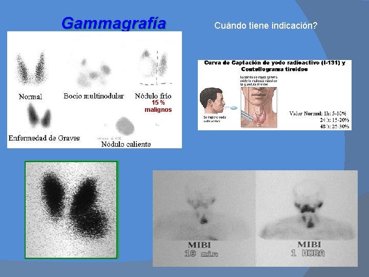 Cuándo tiene indicación? 15 % malignos 