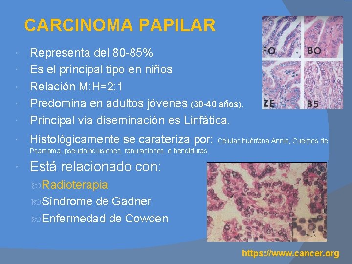CARCINOMA PAPILAR Representa del 80 -85% Es el principal tipo en niños Relación M: