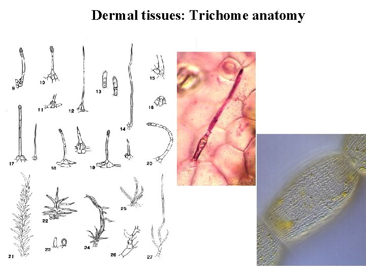 Dermal tissues: Trichome anatomy Epidermis 