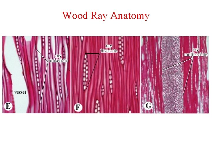 Wood Ray Anatomy 