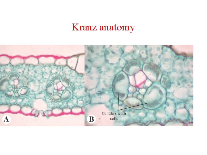 Kranz anatomy 