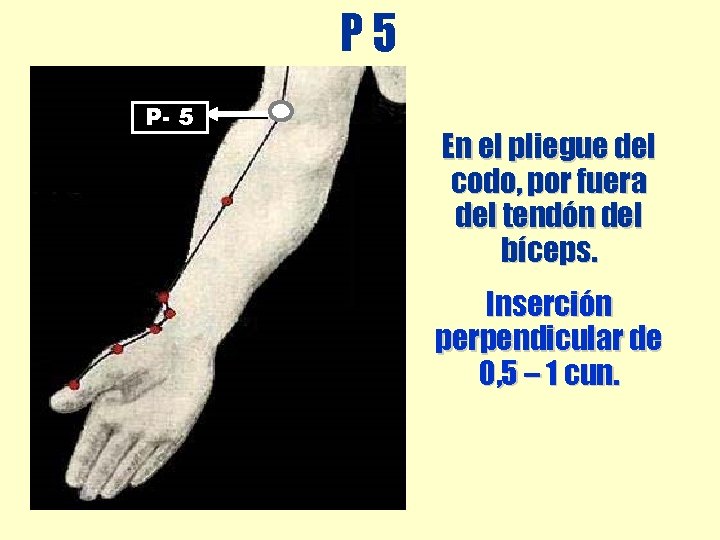 P 5 P- 5 En el pliegue del codo, por fuera del tendón del P 5 P- 5 En el pliegue del codo, por fuera del tendón del