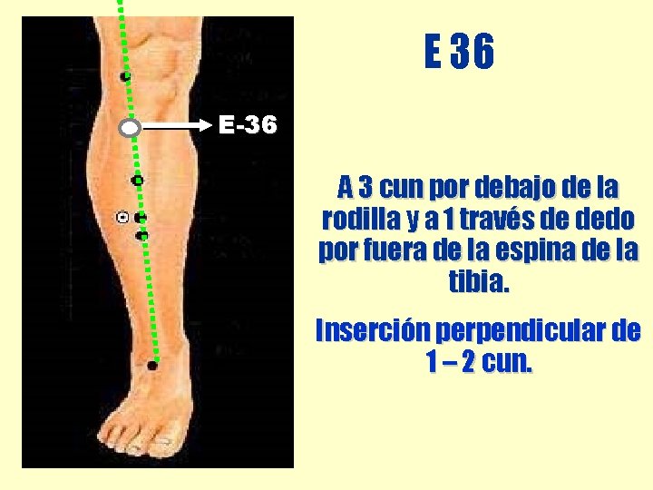 E 36 E-36 A 3 cun por debajo de la rodilla y a 1 E 36 E-36 A 3 cun por debajo de la rodilla y a 1