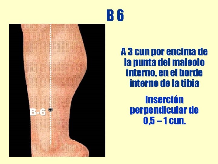 B 6 A 3 cun por encima de la punta del maleolo interno, en B 6 A 3 cun por encima de la punta del maleolo interno, en