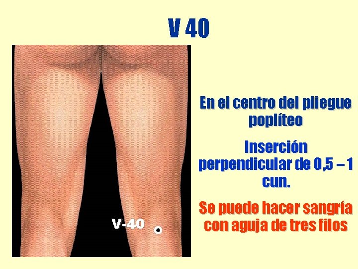 V 40 En el centro del pliegue poplíteo Inserción perpendicular de 0, 5 – V 40 En el centro del pliegue poplíteo Inserción perpendicular de 0, 5 –