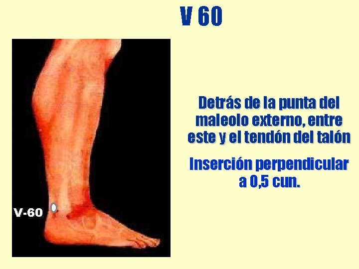 V 60 Detrás de la punta del maleolo externo, entre este y el tendón V 60 Detrás de la punta del maleolo externo, entre este y el tendón