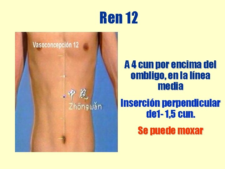 Ren 12 A 4 cun por encima del ombligo, en la línea media Inserción Ren 12 A 4 cun por encima del ombligo, en la línea media Inserción