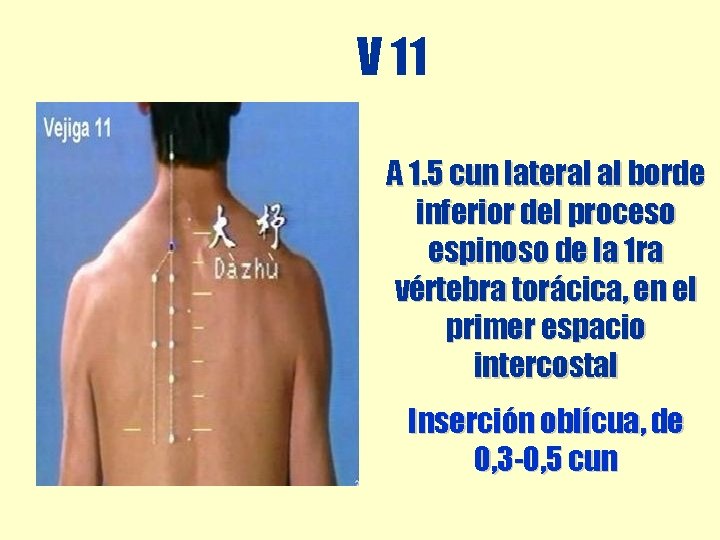 V 11 A 1. 5 cun lateral al borde inferior del proceso espinoso de V 11 A 1. 5 cun lateral al borde inferior del proceso espinoso de