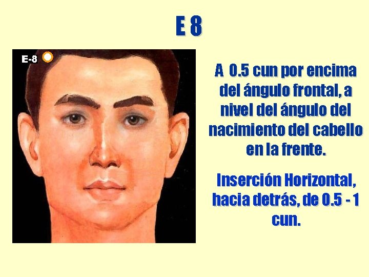 E 8 A 0. 5 cun por encima del ángulo frontal, a nivel del E 8 A 0. 5 cun por encima del ángulo frontal, a nivel del