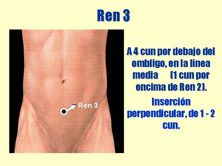 Ren 3 A 4 cun por debajo del ombligo, en la línea media (1 Ren 3 A 4 cun por debajo del ombligo, en la línea media (1