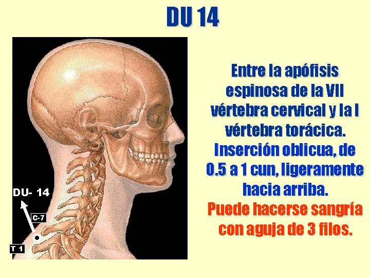 DU 14 DU- 14 C-7 T 1 Entre la apófisis espinosa de la VII DU 14 DU- 14 C-7 T 1 Entre la apófisis espinosa de la VII