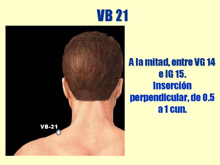 VB 21 A la mitad, entre VG 14 e IG 15. Inserción perpendicular, de VB 21 A la mitad, entre VG 14 e IG 15. Inserción perpendicular, de