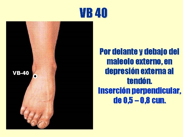 VB 40 VB-40 Por delante y debajo del maleolo externo, en depresión externa al VB 40 VB-40 Por delante y debajo del maleolo externo, en depresión externa al