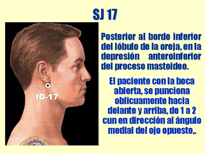 SJ 17 Posterior al borde inferior del lóbulo de la oreja, en la depresión SJ 17 Posterior al borde inferior del lóbulo de la oreja, en la depresión