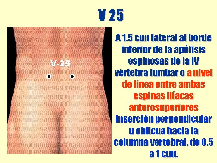 V 25 V-25 A 1. 5 cun lateral al borde inferior de la apófisis V 25 V-25 A 1. 5 cun lateral al borde inferior de la apófisis
