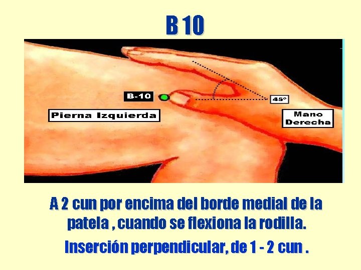 B 10 A 2 cun por encima del borde medial de la patela , B 10 A 2 cun por encima del borde medial de la patela ,