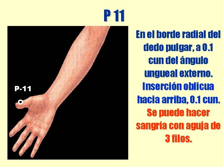 P 11 P-11 En el borde radial dedo pulgar, a 0. 1 cun del P 11 P-11 En el borde radial dedo pulgar, a 0. 1 cun del