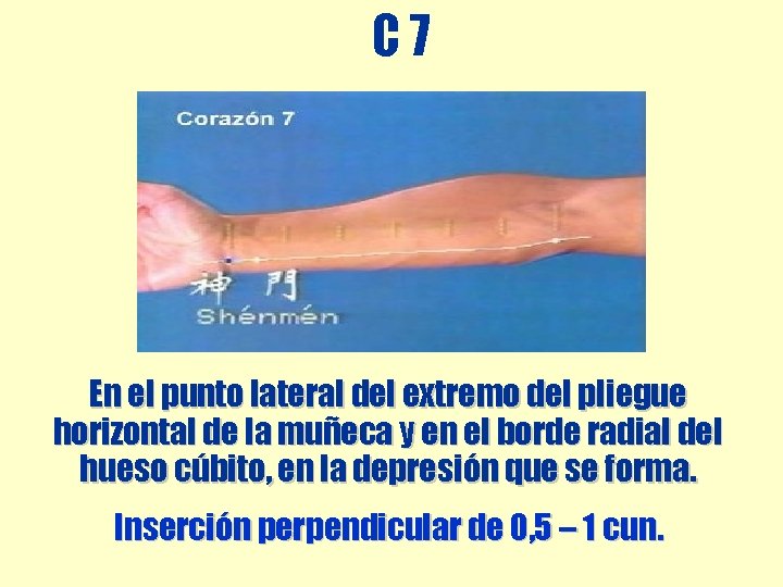 C 7 En el punto lateral del extremo del pliegue horizontal de la muñeca C 7 En el punto lateral del extremo del pliegue horizontal de la muñeca
