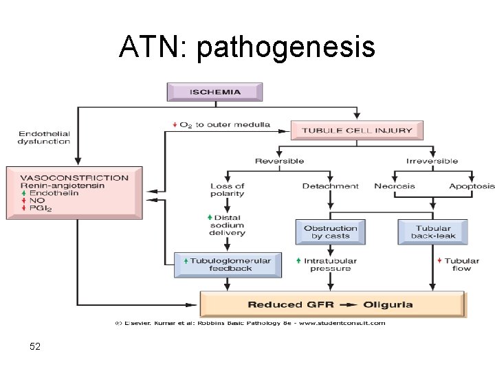 ATN: pathogenesis 52 