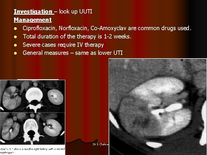 Investigation – look up UUTI Management l Ciprofloxacin, Norfloxacin, Co-Amoxyclav are common drugs used.