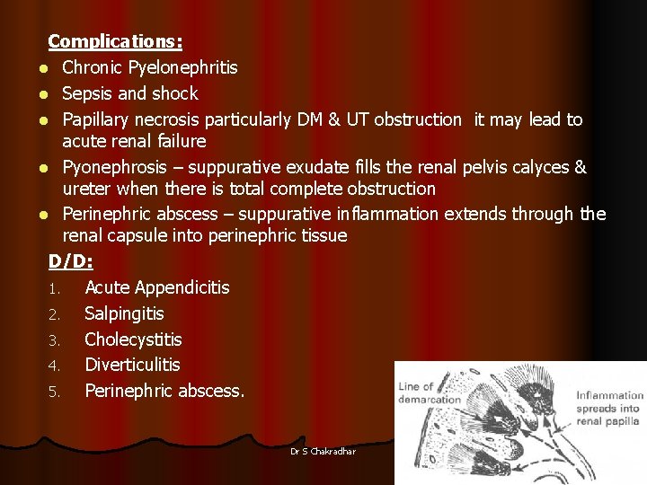 Complications: l Chronic Pyelonephritis l Sepsis and shock l Papillary necrosis particularly DM &