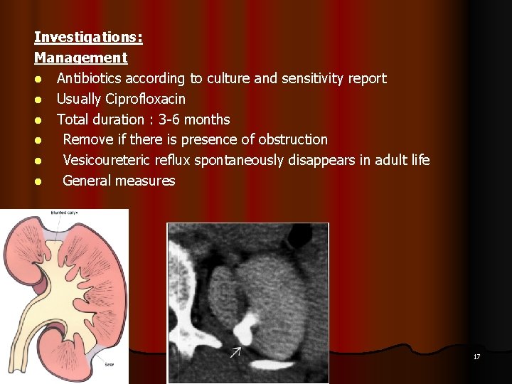 Investigations: Management l Antibiotics according to culture and sensitivity report l Usually Ciprofloxacin l