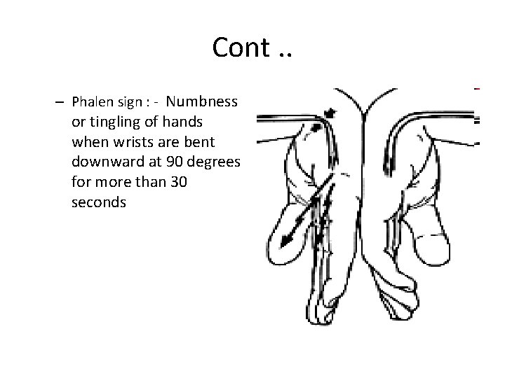 Cont. . – Phalen sign : - Numbness or tingling of hands when wrists