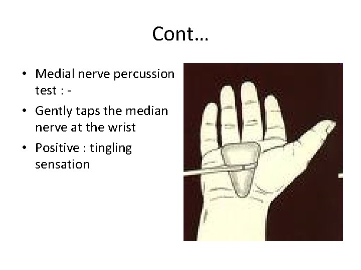 Cont… • Medial nerve percussion test : • Gently taps the median nerve at
