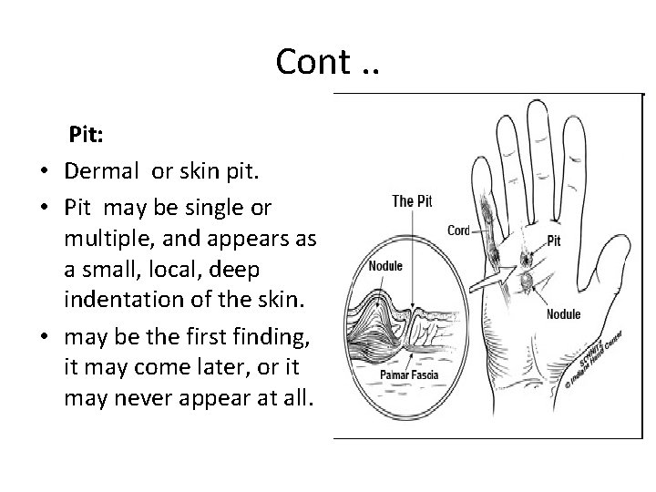 Cont. . Pit: • Dermal or skin pit. • Pit may be single or