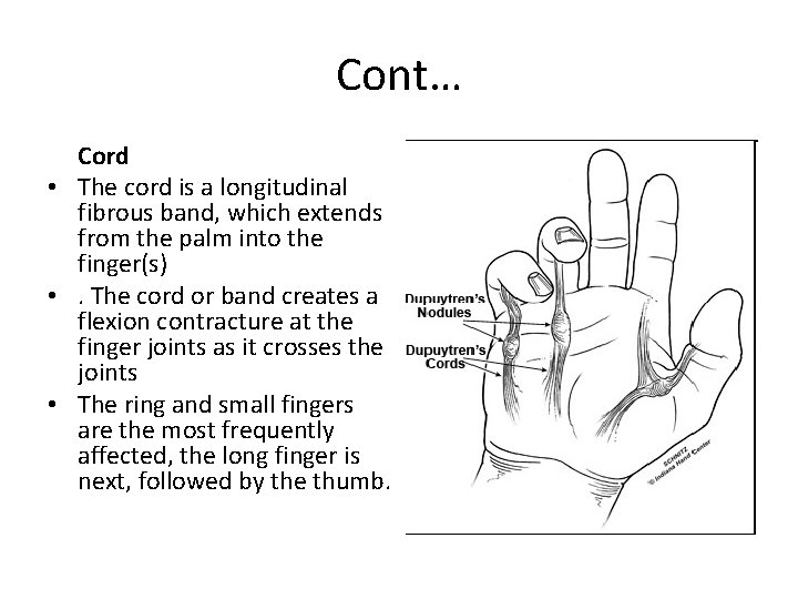 Cont… Cord • The cord is a longitudinal fibrous band, which extends from the