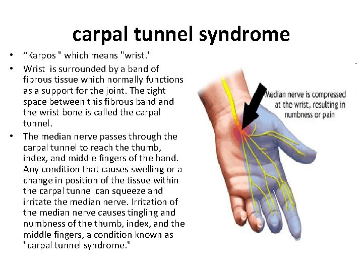 carpal tunnel syndrome • “Karpos " which means "wrist. " • Wrist is surrounded