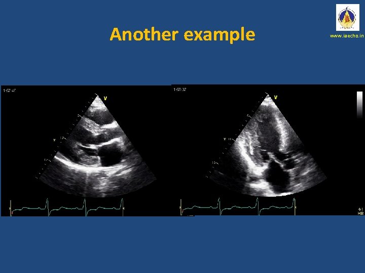 Another example www. iaecho. in 