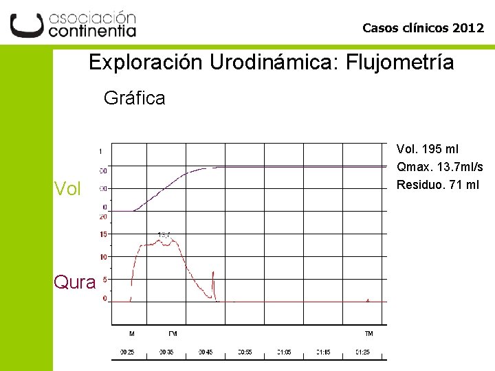 Casos clínicos 2012 Exploración Urodinámica: Flujometría Gráfica Vol Qura Vol. 195 ml Qmax. 13.