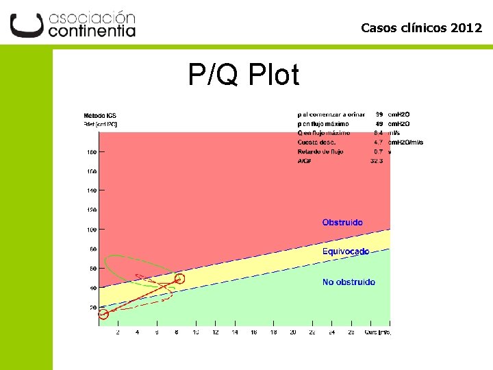 Casos clínicos 2012 P/Q Plot 