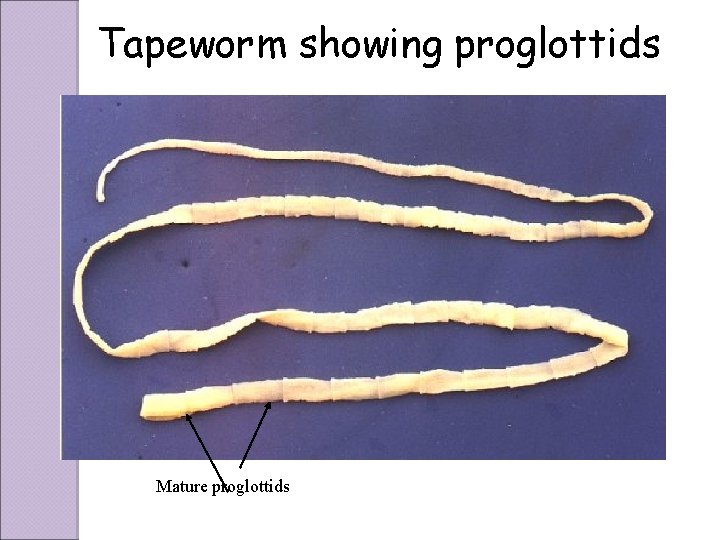 Tapeworm showing proglottids Mature proglottids 