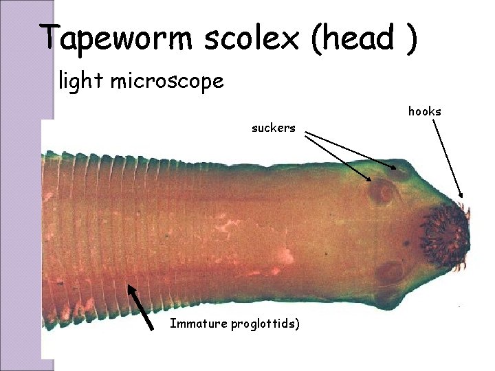 Tapeworm scolex (head ) light microscope suckers Immature proglottids) hooks 