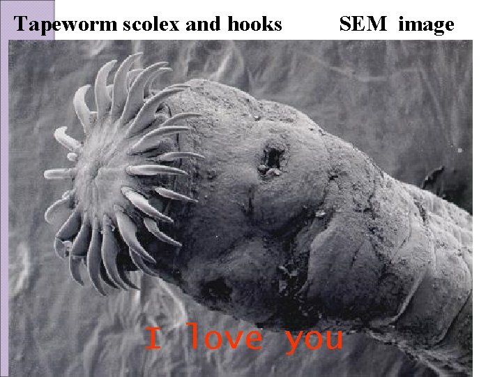 Tapeworm scolex and hooks SEM image I love you 