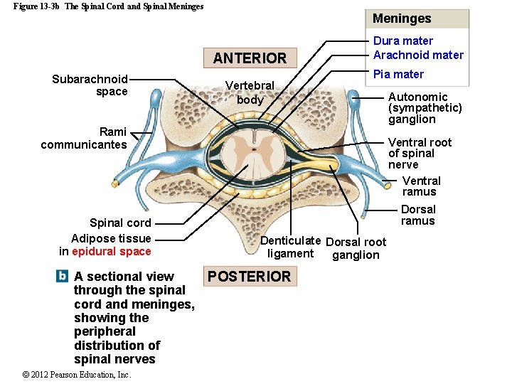 Figure 13 -3 b The Spinal Cord and Spinal Meninges ANTERIOR Subarachnoid space Vertebral