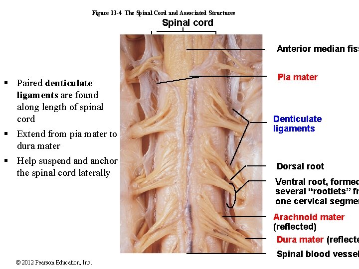 Figure 13 -4 The Spinal Cord and Associated Structures Spinal cord Anterior median fiss