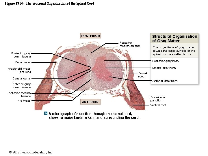 Figure 13 -5 b The Sectional Organization of the Spinal Cord POSTERIOR Posterior median