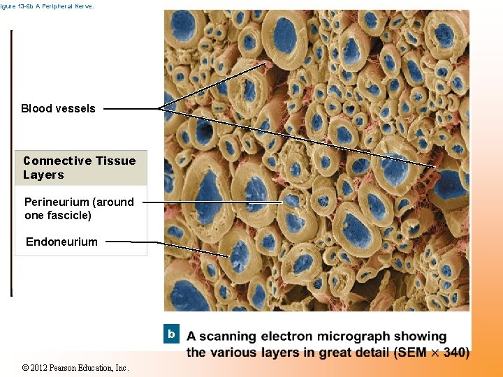 Figure 13 -6 b A Peripheral Nerve. Blood vessels Connective Tissue Layers Perineurium (around