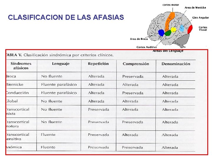 CLASIFICACION DE LAS AFASIAS 