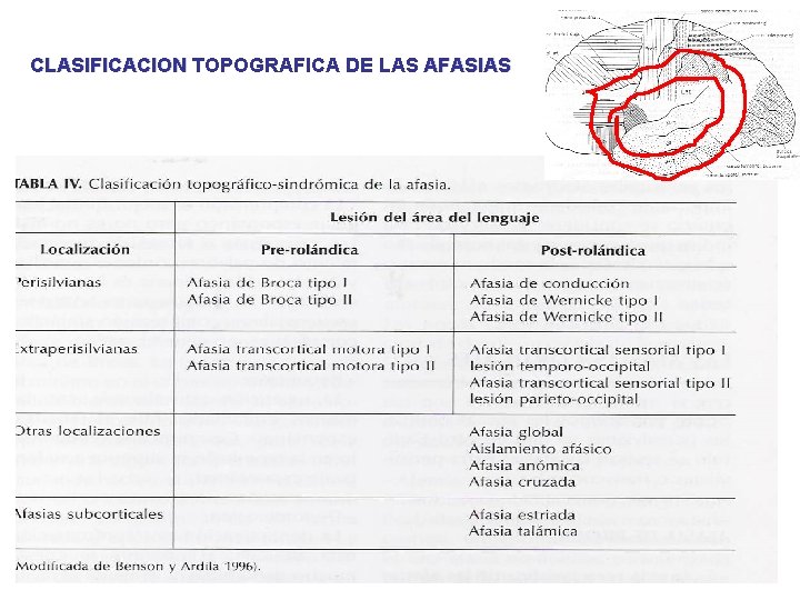 CLASIFICACION TOPOGRAFICA DE LAS AFASIAS 