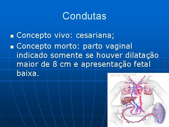 Condutas n n Concepto vivo: cesariana; Concepto morto: parto vaginal indicado somente se houver