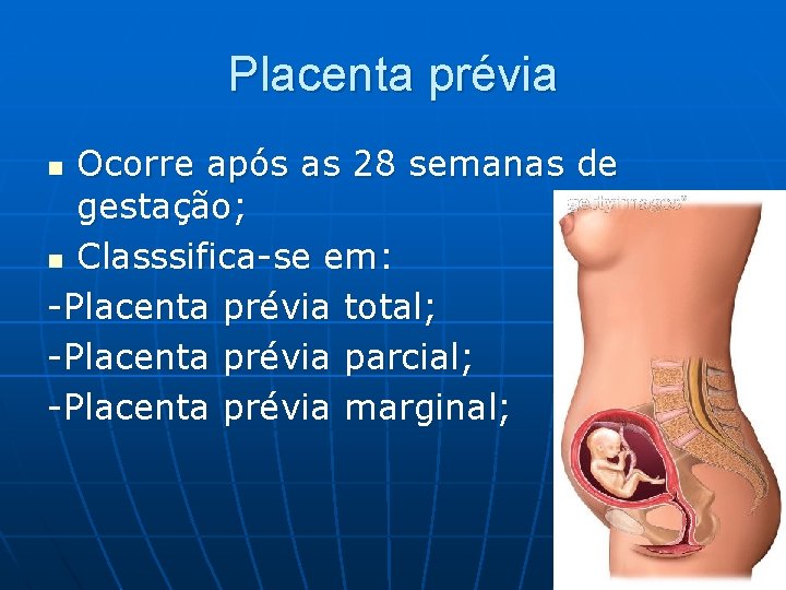 Placenta prévia Ocorre após as 28 semanas de gestação; n Classsifica-se em: -Placenta prévia