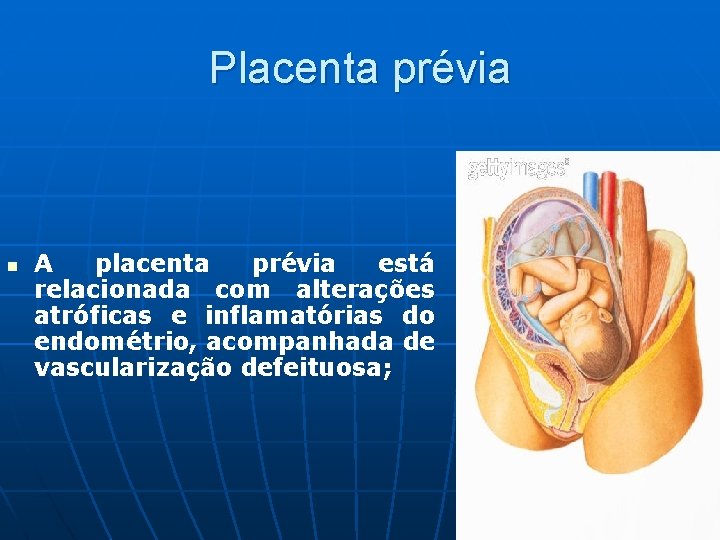 Placenta prévia n A placenta prévia está relacionada com alterações atróficas e inflamatórias do