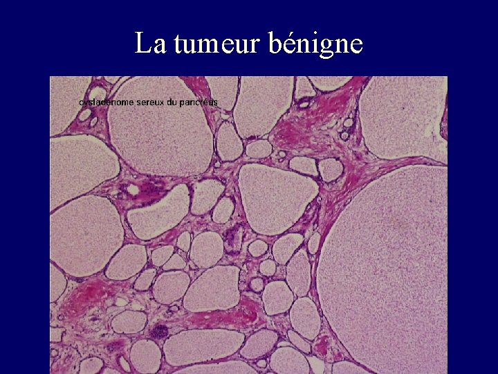 ANATOMIE PATHOLOGIQUE GENERALITES ANATOMIE PATHOLOGIE GENERALE 34 heures