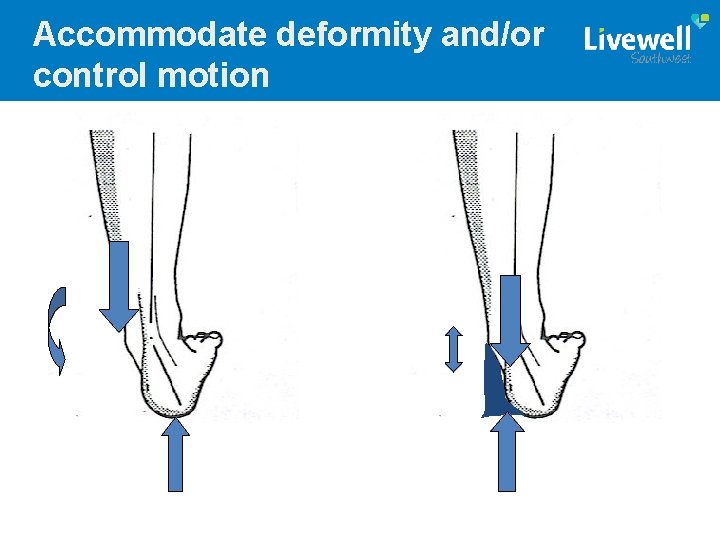 Accommodate deformity and/or control motion 